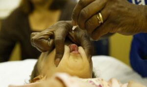 Unidades de Saúde dão início a Campanha de Nacional contra Poliomielite e Multivacinação
