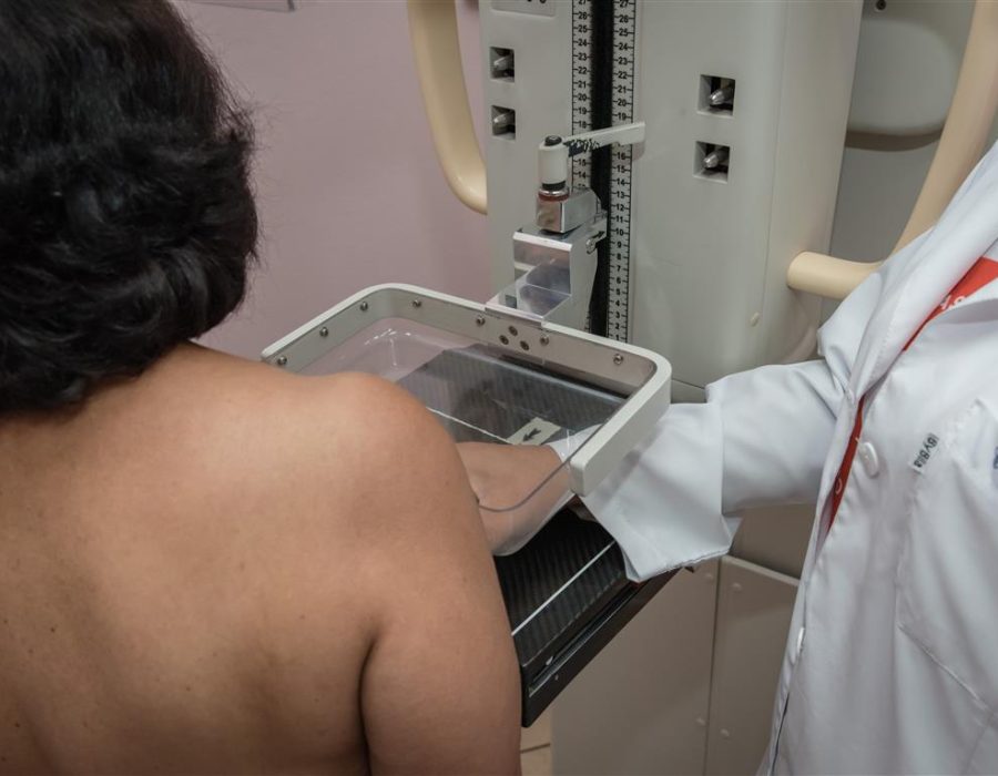 2025-07-23-15-12-38-mamografia-8