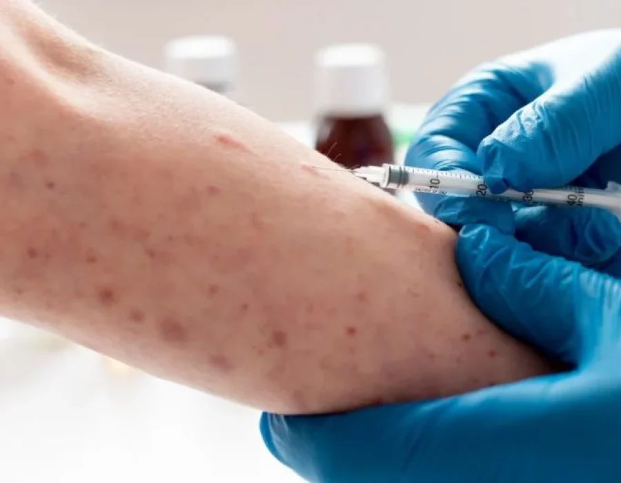 Braco-com-vacina-MPOX-768x511