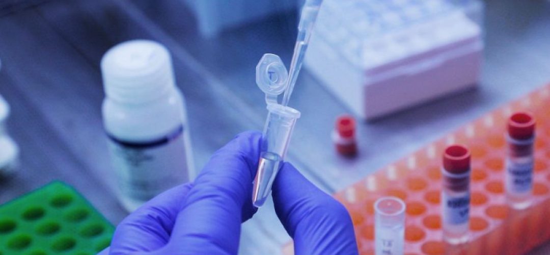 diagnostico_novo_coronavirus_fiocruz_covid_19-6