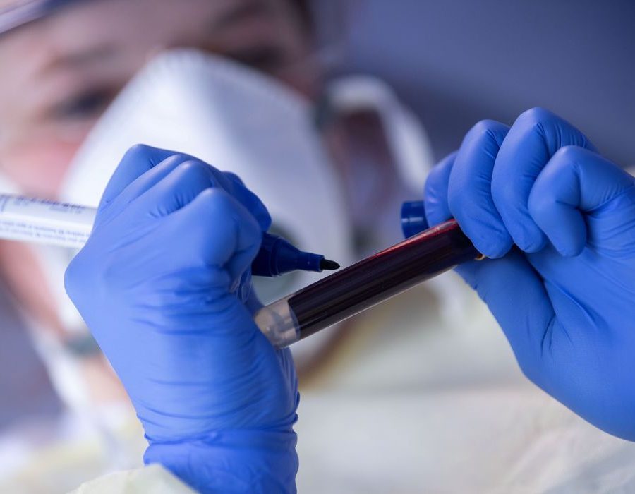 health-coronavirus-rki-study