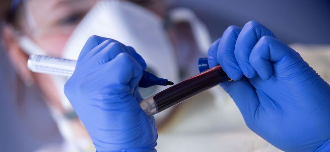 health-coronavirus-rki-study
