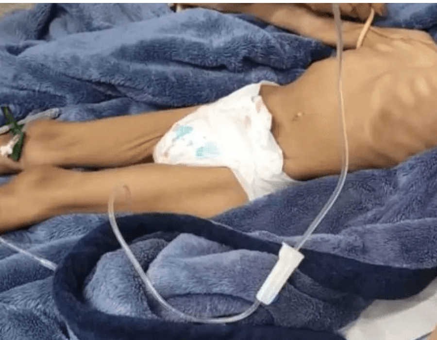 menina-desnutrida-rio-claro-030623