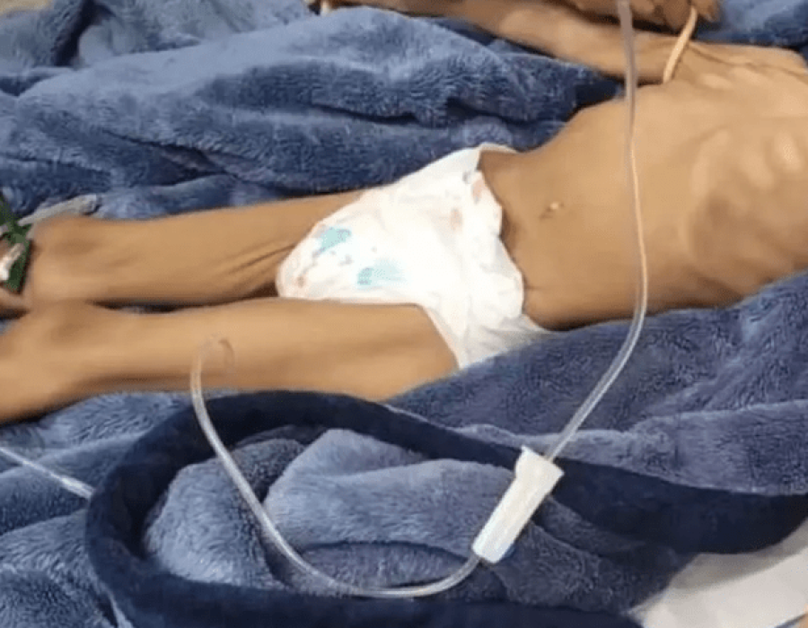 menina-desnutrida-rio-claro-040324