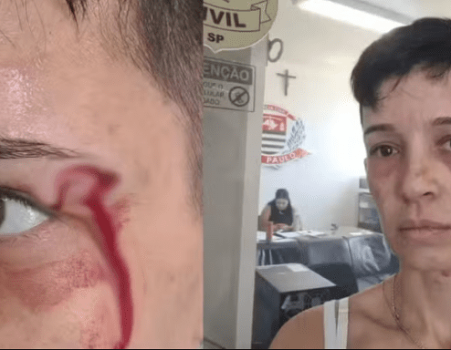 mulher-agredida-itapetininga-040424-768x384