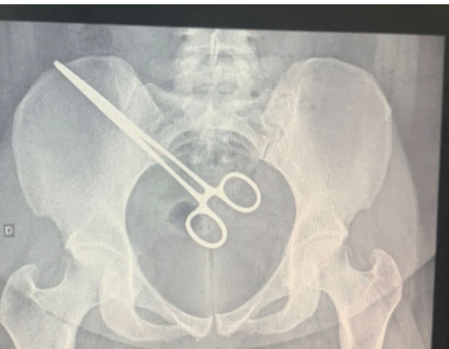 mulher-pinca-corpo-151123